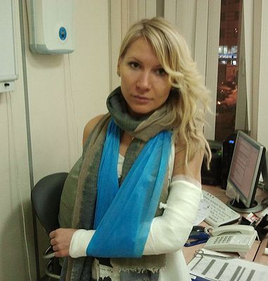 Соратнице новосибирского депутата сломали руку на митинге в Москве