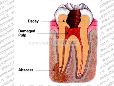  www.metrogyl-denta.ru/periodontit